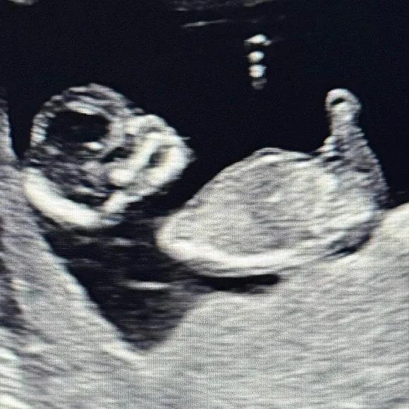 … - Picture 3 of 16